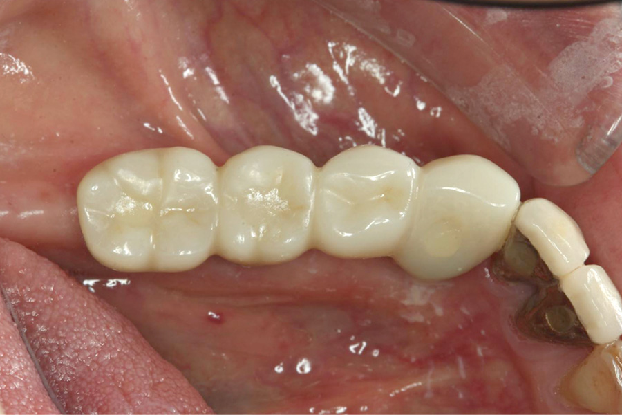 治療後症例写真