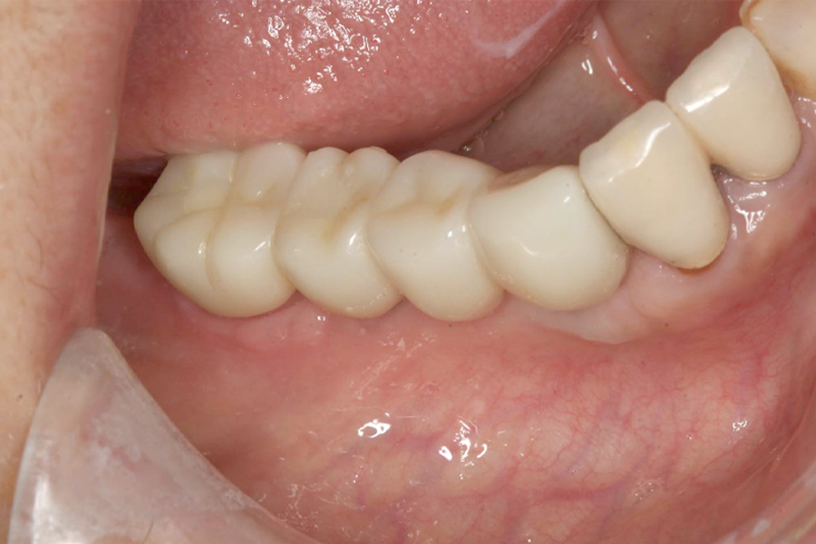 治療後症例写真