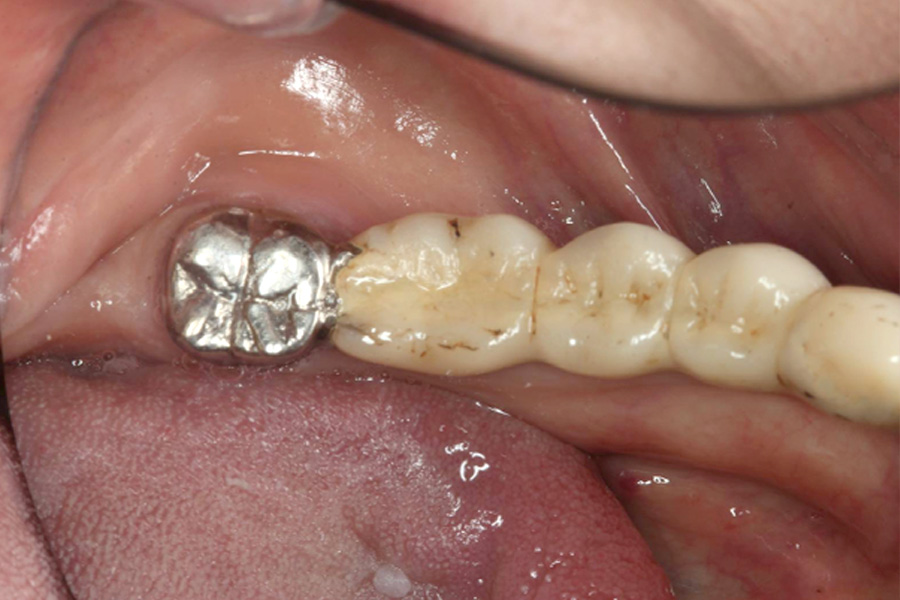 治療前症例写真